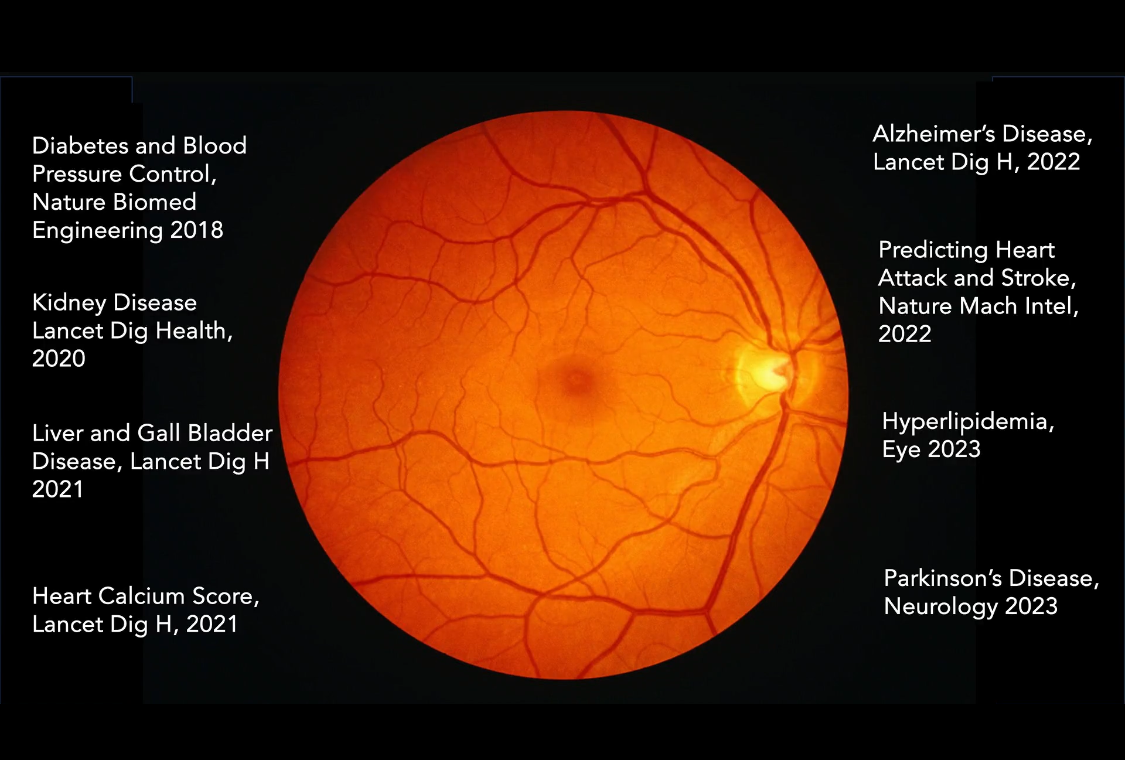 Retinal photograph with surrounding examples of systemic diseases and cardiovascular risks associated with retinal imaging.